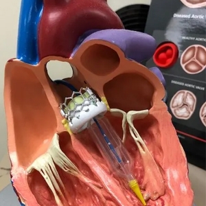 Aortic Valve Disease